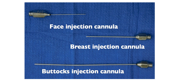 Λιπομεταφορά (Εμφύτευση λίπους)