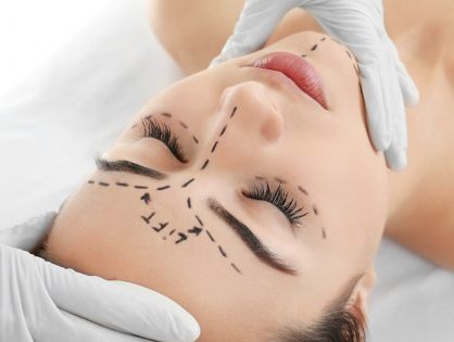 Μετωπιαίο Λίφτινγκ