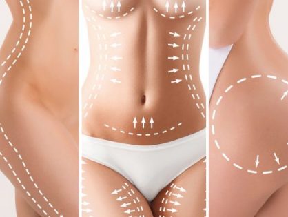 Λιπομεταφορά (Εμφύτευση λίπους)